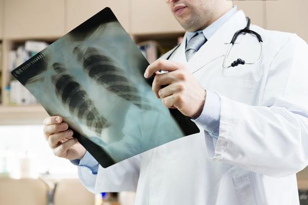Lung Function